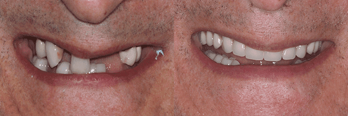 Before and after - dentist in Scottsdale, AZ