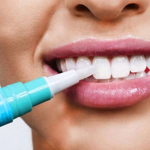 Woman whitening her teeth