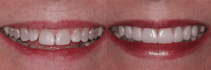 Before and after - dentist in Scottsdale, AZ